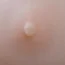 膚色 